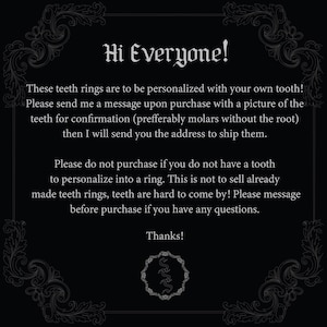 Gepersonaliseerde tandringen! *LEES VR AANKOOP*