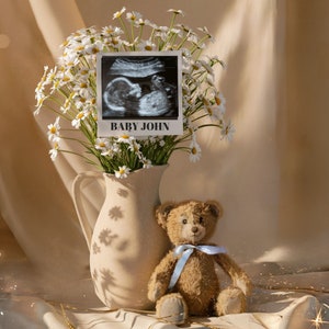 May include: A still-life composition featuring a vase of daisies, an ultrasound image labeled "BABY JOHN," and a teddy bear with a blue ribbon. The ultrasound image is black and white. The teddy bear is brown.