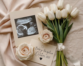 May include: A white ultrasound image of a baby in a white frame, a bouquet of white roses, and a card with the text "Baby Angelia October 2025".