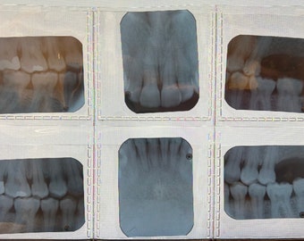 Vintage Dental X-rays