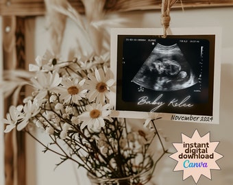 Neutral Pregnancy Announcement Digital, Rustic Pregnancy Announcement, Social Media Pregnancy Template, Simple Minimalist Baby Announcement