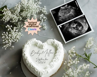 May include: A white heart-shaped cake with the words "Baby Miller September 2024" written in black icing. The cake is surrounded by white flowers and two ultrasound images are in the background.
