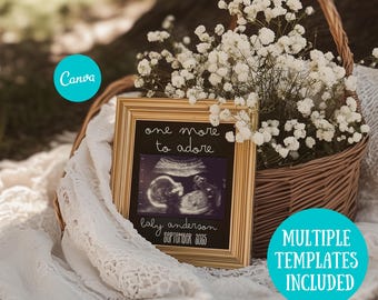 Second Baby Announcement Template: Minimalist Ultrasound Reveal (Digital Download)