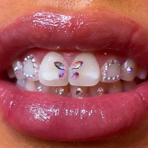 Puede incluir: Primer plano de una sonrisa con varios peque&ntilde;os diamantes de imitaci&oacute;n transparentes e iridiscentes que decoran los dientes.