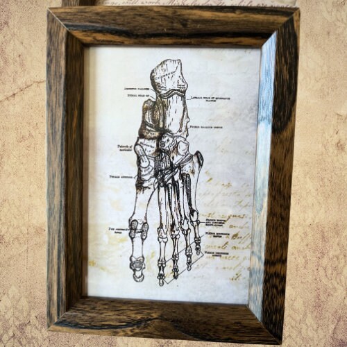 Antique Skeletal System Collage Frame Medical Diagram. Autopsy, Surgery ...
