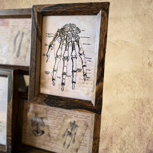 Antique Skeletal System Collage Frame Medical Diagram. Autopsy, Surgery ...