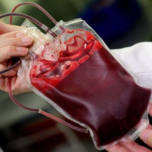 Puede incluir: Una bolsa de plástico transparente llena de sangre roja, sostenida por una mano que lleva una bata de laboratorio blanca.