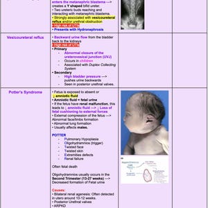 Hoogrenderende nierpathologiegrafiek voor geneeskundestudenten | Stap 1 en stap 2 Studiehulp | Cheatsheets digitaal downloaden