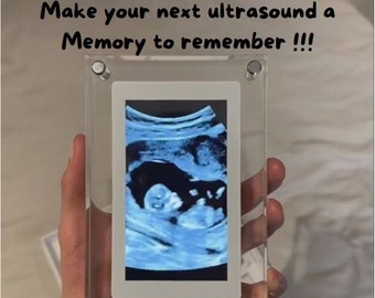 Cadre photo numérique acrylique unique de 5 pouces, parfait pour garder la mémoire, excellent cadeau de pendaison de crémaillère, parfait pour les femmes enceintes