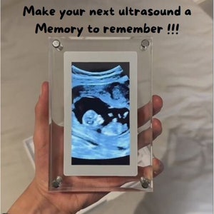 Unique 5 Inch Acrylic Digital Photo Frame, Perfect Memory Keeper, Great Housewarming Gift-perfect for Pregnant mother's image 1