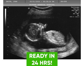 Ultrasonido de broma personalizado: imagen de ecografía de embarazada personalizada con nombre, fecha y hospital