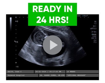 Personalized Prank Ultrasound Video - Custom Pregnant Sonogram with Name, Date, Hospital