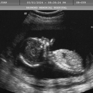 Prank Ultrasound Image, Personalized Pregnancy Sonogram Image with Name, Date, Time, Hospital, Fake Ultrasound