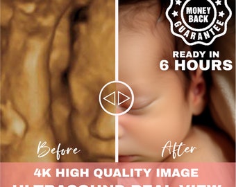 Echografie 8k babybeeld 3d 4d 5d 8d Real View Baby AI fototransformatie Echografie Scant eerste babyfoto