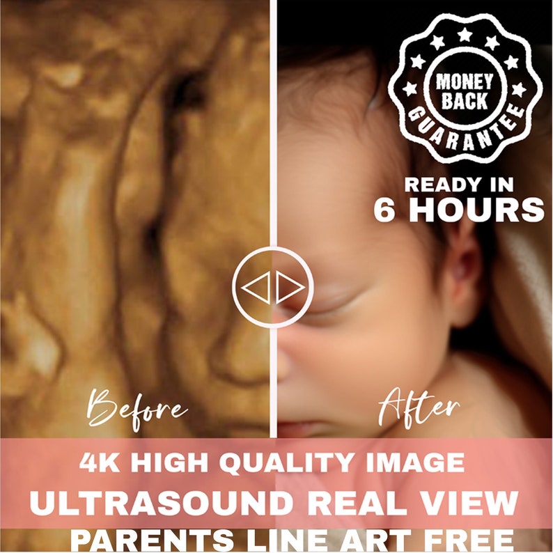Ultrasound 8k baby image 3d 4d 5d 8d Real View Baby AI photo transformation Echography Scans first baby photo image 1