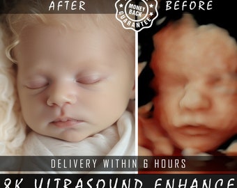 8K verbeterde echografie: van hobbels tot realistische gezichten | Precisie 3D/4D/5D/HD-beeldvorming | Perfecte babyshowerverrassing en echografiecadeau Ai