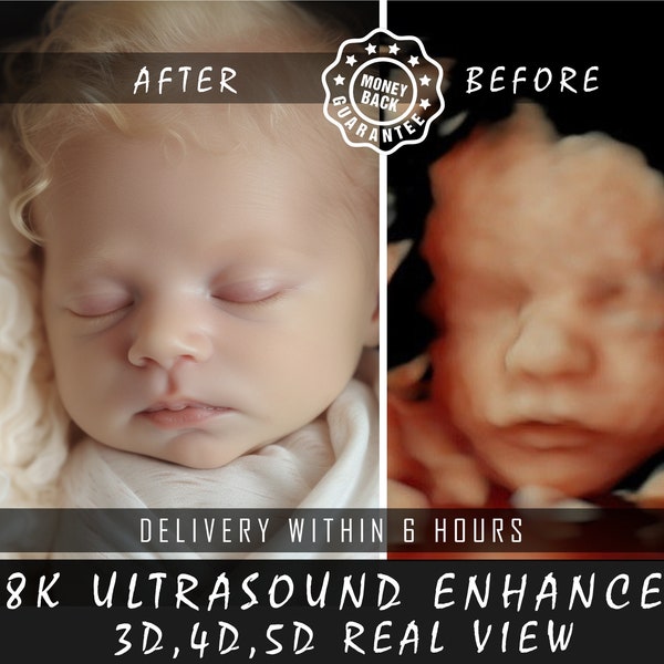 8K-verstärkter Ultraschall: Von Unebenheiten zu realistischen Gesichtern | Präzise 3D/4D/5D/HD-Bildgebung | Perfekte Babyparty-Überraschung und Ultraschall-Geschenk