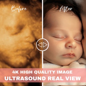 Ultrasound 8k baby image 3d 4d 5d 8d Real View Baby AI photo transformation Echography Scans first baby photo image 2