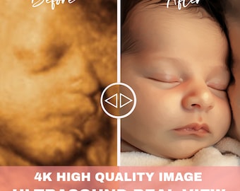 8K verbeterde echografie: van hobbels tot realistische gezichten | Precisie 3D/4D/5D/HD-beeldvorming | Perfect en echografie cadeau