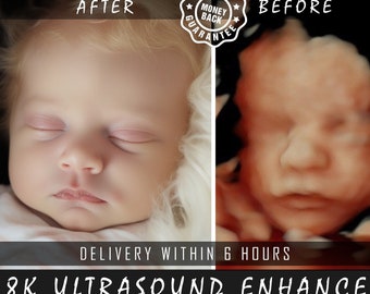 8K verbeterde echografie: van hobbels tot realistische gezichten | Precisie 3D/4D/5D/HD-beeldvorming | Perfecte babyshowerverrassing en echografiecadeau Ai