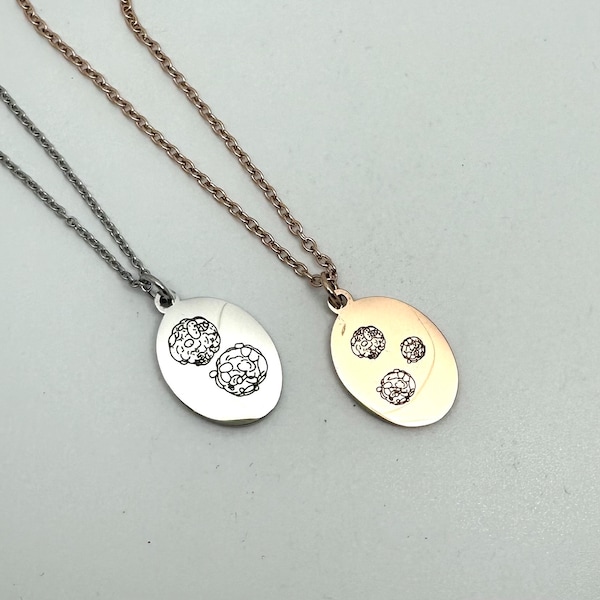 Custom embryo engraved stainless steel heart, disk or oval pendant necklace. Put your embryo picture on a necklace.