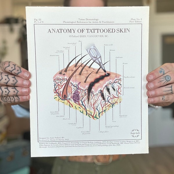 Fig. 3 “Anatomy of Tattooed Skin” Tattoo Dermatology Art Print