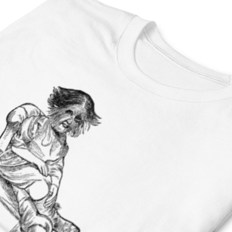 Fedor Jeftichew Aka Jo-jo the Dog-faced Boy Scientific Illustration T ...