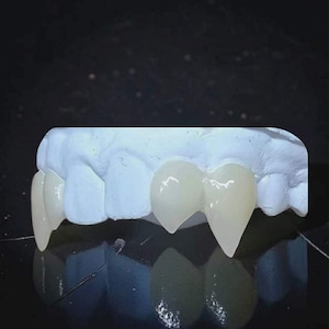 Order by Oct 9 for Halloween Outside UK | Custom 4 Set Vampire Fangs | Precision Milled Dental Acrylic Fang Caps | No Glue image 5