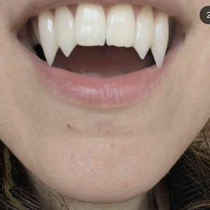 Order by Oct 9 for Halloween Outside UK | Custom 4 Set Vampire Fangs | Precision Milled Dental Acrylic Fang Caps | No Glue image 6