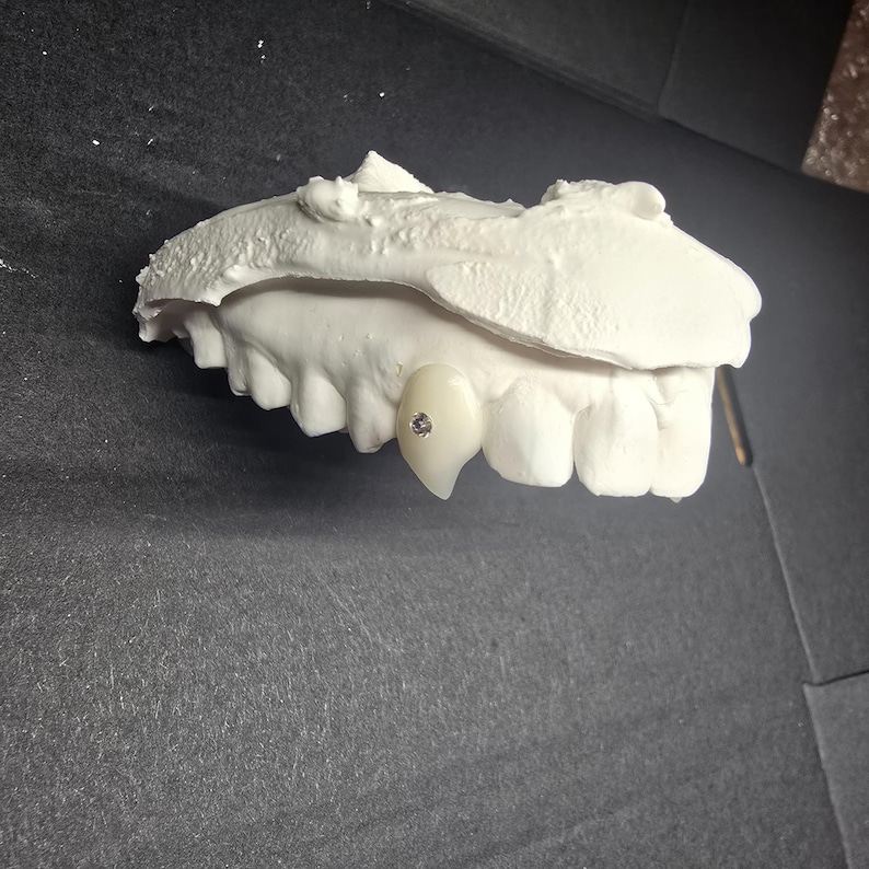 May include: A dental model with a white, tooth-shaped crown featuring a small, sparkling gem. The model includes a full set of white teeth and a textured upper portion, all set against a dark background.