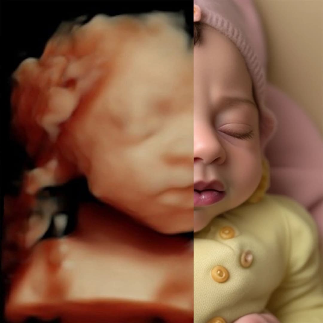 Realistic Ultrasound Accurate Baby Preview From 3d Etsy