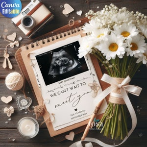 Digitale Blume Neutral Buch Schwangerschaft Ankündigung Baby offenbaren Neutral Geschlecht Social Media Facebook Instagram bearbeitbare Vorlage Canva Boy
