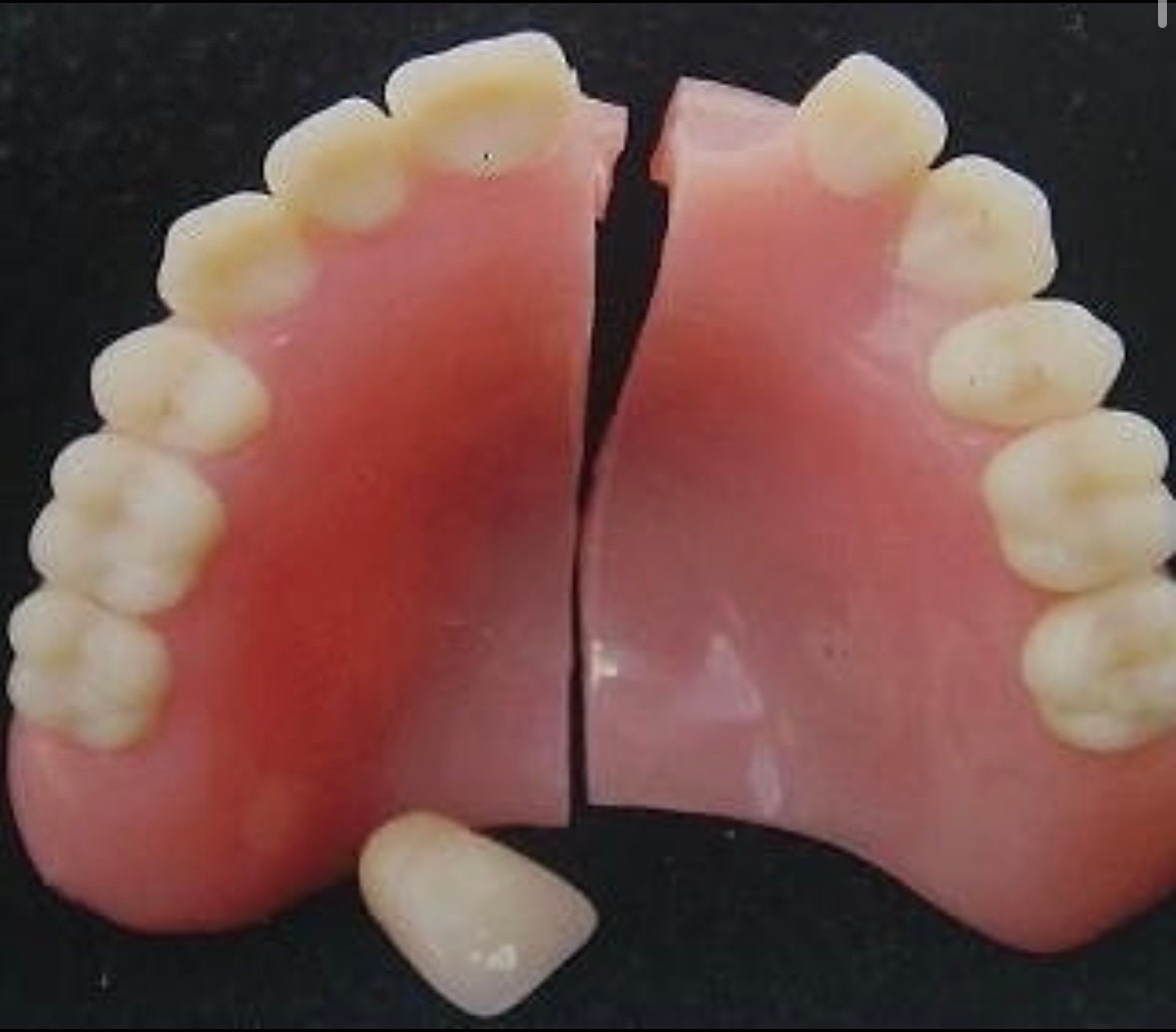 Denture Tooth Repair Etsy