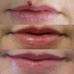 Overnight Healing Lip Goop, Lip Mask, Dry Lips Remedy, Calendula, Lanolin image 4