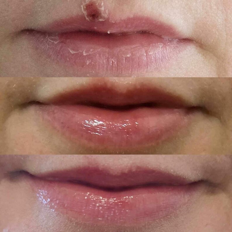 Overnight Healing Lip Goop, Lip Mask, Dry Lips Remedy, Calendula, Lanolin image 4