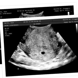 Personalized Prank Pregnant Realistic Black and White Ultrasound image 3