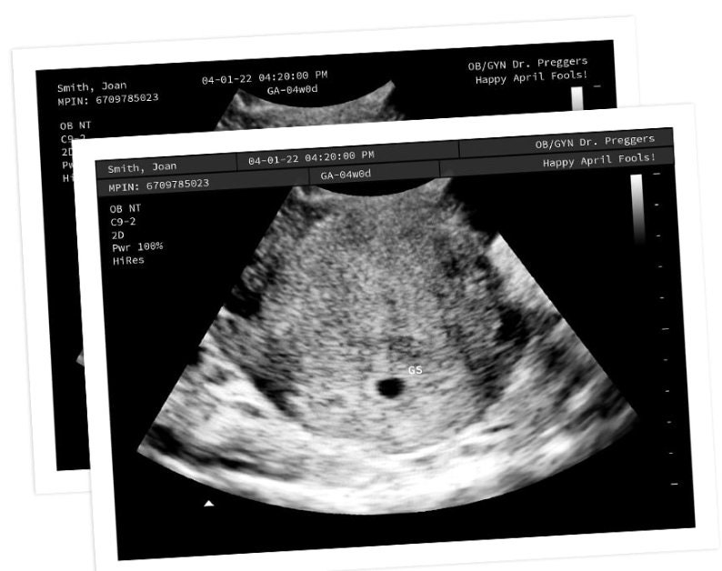 Personalized Prank Pregnant Realistic Black and White Ultrasound image 3