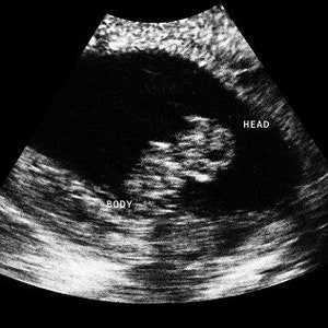 Personalized Prank Pregnant Realistic Black and White Ultrasound image 2