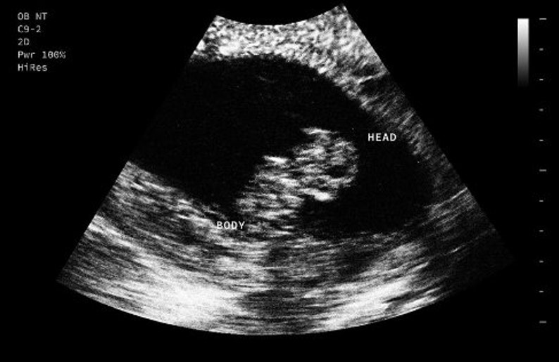 Personalized Prank Pregnant Realistic Black and White Ultrasound image 2