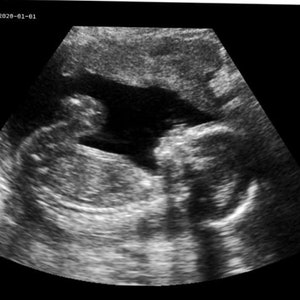 Personalisierter Streich schwangerer realistischer Schwarz-Weiß-Ultraschall Bild 1