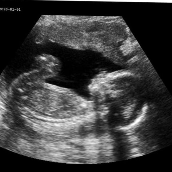 Personalisierter Streich schwangerer realistischer Schwarz-Weiß-Ultraschall