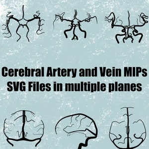 May include: Six black and white line drawings of the human brain's vascular system in different planes. The drawings are labeled "Cerebral Artery and Vein MIPs SVG Files in multiple planes".