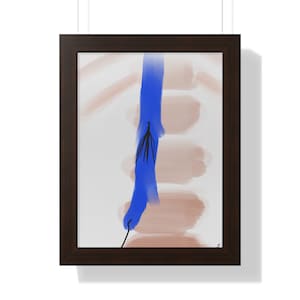 Radiology IR Art Framed Poster of IVC Filter Inferior Vena Cava Venogram