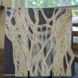 May include: A close-up of a white, organic, textured, abstract design on a black background. The design resembles a network of veins or branches. The image is signed "Erickson. 24".