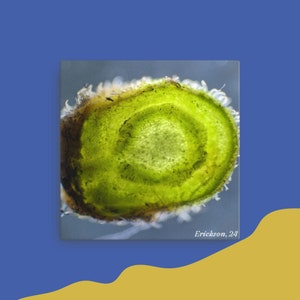 May include: A close-up of a cross-section of a plant stem, showing the green vascular tissue and the brown outer layer. The image is labeled "Erickson, 24".