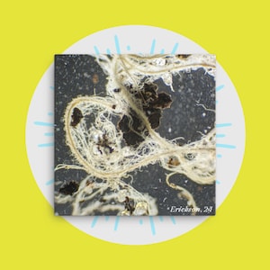 May include: A close-up image of a microscopic sample showing a white, stringy, web-like structure with dark brown, circular shapes scattered throughout. The image is labeled "Erickson, 24".