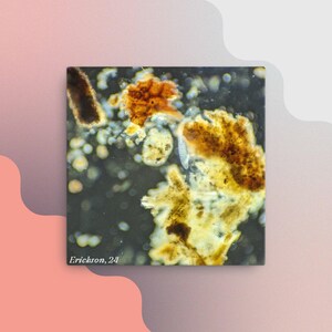 May include: A close-up image of a microscopic sample with brown, yellow, and white organic matter on a dark background. The image is labeled "Erickson, 24".