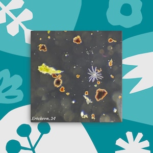 May include: A microscopic image showing a dark background with small, round, orange and brown shapes scattered throughout. A single, white, star-shaped object is in the center of the image. The text "Erickson, 24" is in the lower left corner of the image.