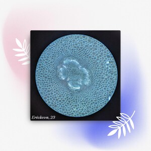 May include: A close-up image of a plant stem viewed under a microscope. The stem is light blue and has a circular, textured pattern. The image is labeled "Erickson, 23".