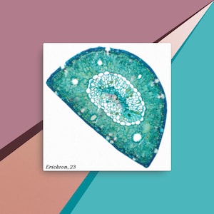 May include: A close-up of a cross-section of a plant stem, showing the internal structure of the vascular tissue. The image is in shades of blue and green, with a white background. The text "Erickson, 23" is visible in the lower left corner.